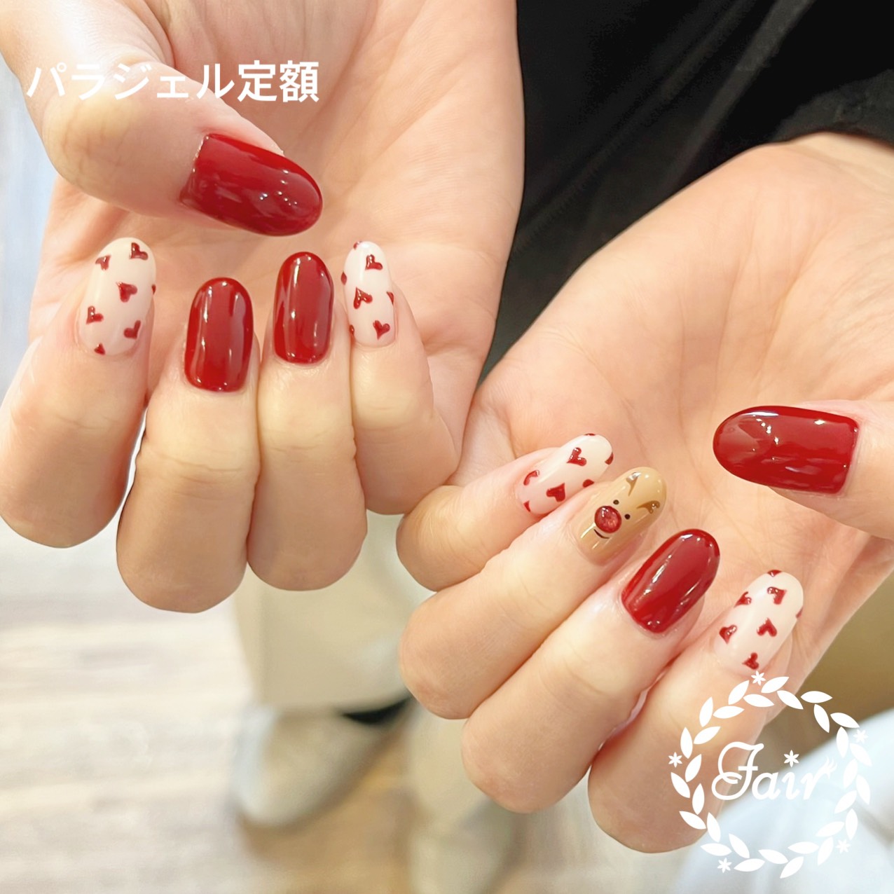 パラジェル定額