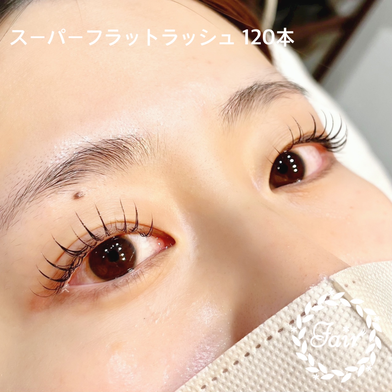 スーパーフラットラッシュ